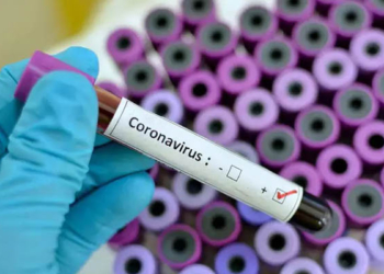 Coronavirus test results